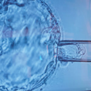 Bireyselleştirilmiş Tedavi