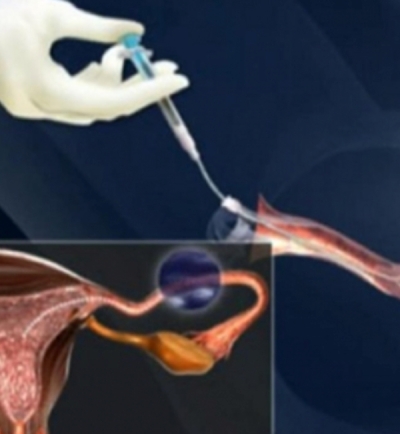 aşılama (inseminasyon)