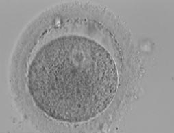 Germinal-vezikül (olgun olmayan) yumurta